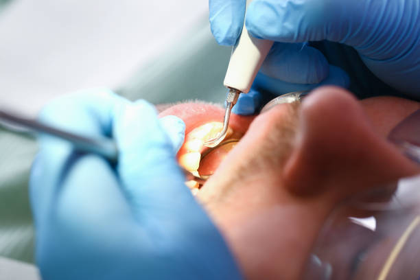Best Weekend Emergency Dentist in Whitehall, MI