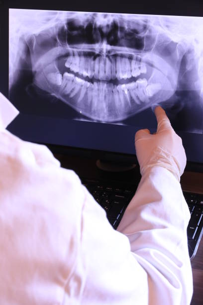 Best Emergency Treatment for Dental Infections or Abscesses in Whitehall, MI